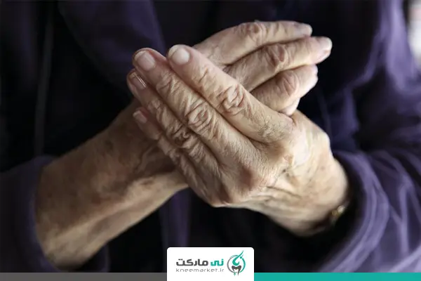 بررسی علت درد مفاصل در زنان - درد مفصل انگشتان دست