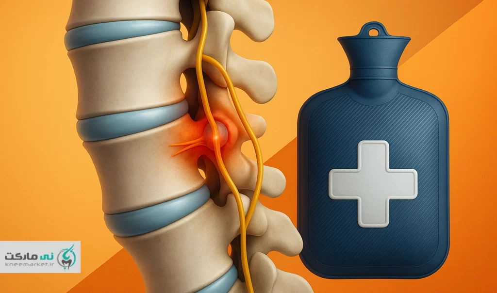 درمان دیسکوپاتی کمر