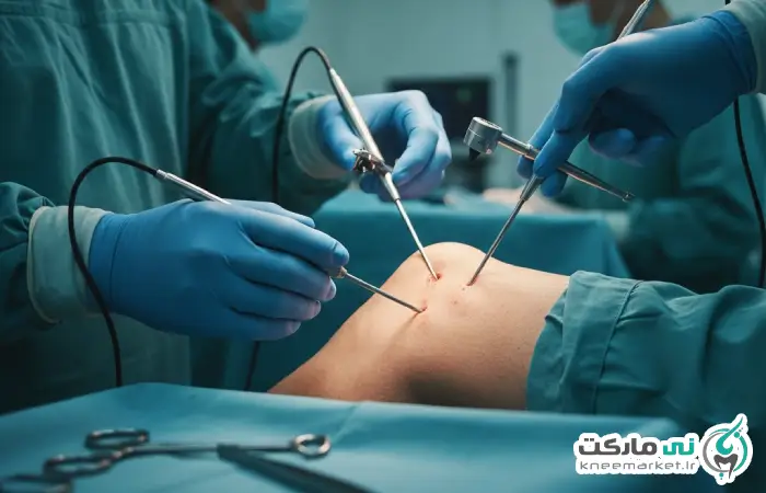 آرتروسکوپی زانو