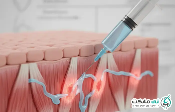 آمپول ضد التهاب برای کاهش درد و التهاب